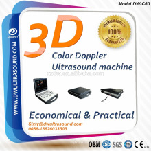 Ecografía Doppler 3D para Cardiac Vessel Liver Kidney Pediatrics y móvil color doppler precio de la máquina de ultrasonido